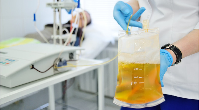 COVID-19の有効な治療法として回復期血漿を使用するためのロードマップを提供する研究(Study provides roadmap for using convalescent plasma as an effective COVID-19 treatment)