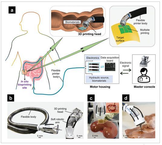 新しいソフトロボットにより、人体内の3Dバイオプリンティングが可能になるかもしれない。(3D bioprinting inside the human body could be possible thanks to new soft robot)
