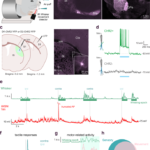 パーキンソン病において、運動は感覚を低下させる(Movement reduces sensory responses in Parkinson’s disease)