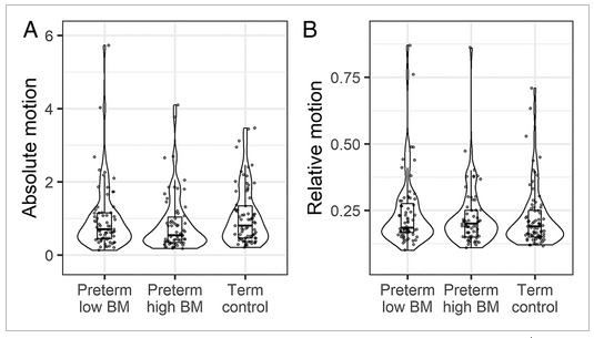 母乳は未熟児の脳の発達を促進する(Breast milk boosts premature babies’ brain development)
