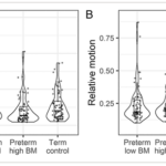 母乳は未熟児の脳の発達を促進する(Breast milk boosts premature babies’ brain development) 母乳は未熟児の脳の発達を促進する(Breast milk boosts premature babies’ brain development)