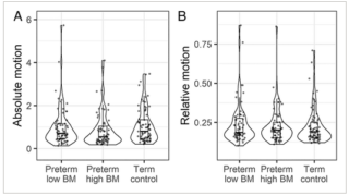 母乳は未熟児の脳の発達を促進する(Breast milk boosts premature babies’ brain development)