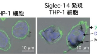カーボンナノチューブを認識する免疫受容体の発見 ～カーボンナノチューブが炎症を引き起こす機構を解明～