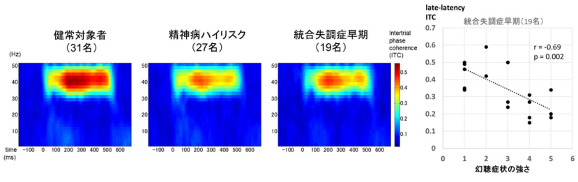 統合失調症の発症早期における聴覚関連脳波応答の特徴が明らかに