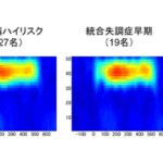 統合失調症の発症早期における聴覚関連脳波応答の特徴が明らかに
