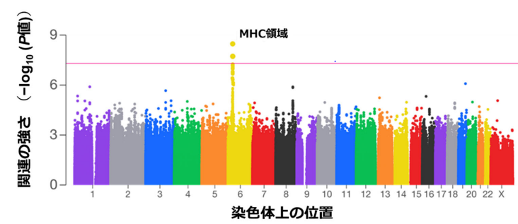 指定難病 間質性膀胱炎(ハンナ型)の遺伝的背景を解明～発症には複数のHLA遺伝子多型が関与していることを明らかに～