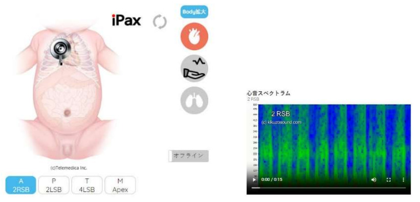 新生児の「聴診」を学べる教育システムを開発 ～周産期医療者のスキルアップで、新生児医療の向上に貢献～