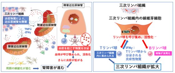 三次リンパ組織による腎障害メカニズムの解明～慢性腎臓病の新たな治療標的候補を同定～