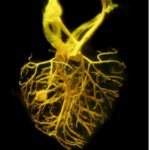 祖先的血管の再構成で進化した、陸上脊椎動物の心臓を支える新規な冠動脈