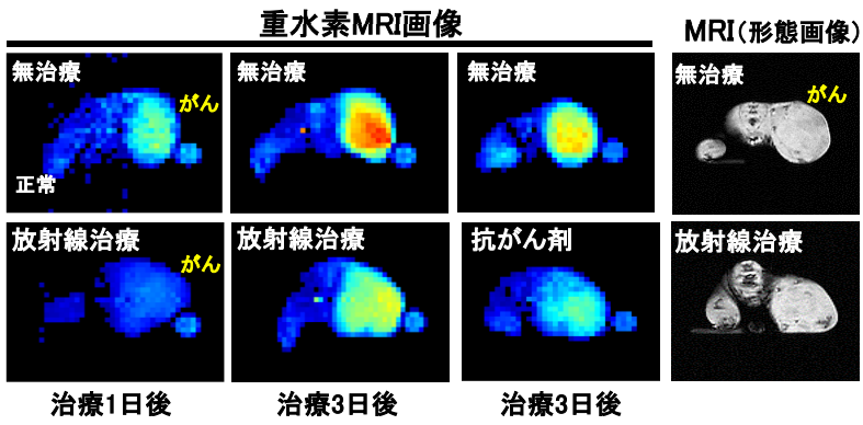 重水素MRIを用いたがん治療効果の早期予測法を開発 ～がん治療における治療効果の早期診断法として期待～