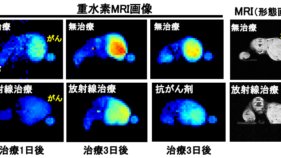 重水素MRIを用いたがん治療効果の早期予測法を開発 ～がん治療における治療効果の早期診断法として期待～