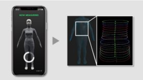 ZOZOSUIT®を用いた側弯症検知～ZOZOSUIT®によって中等症以上の側弯症の検知に成功～