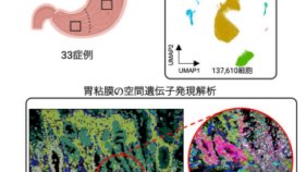 胃を構成する細胞の空間情報を含めたアトラスの作成～新たな上皮幹細胞マーカーや腸上皮化生に関わる線維芽細胞の同定～