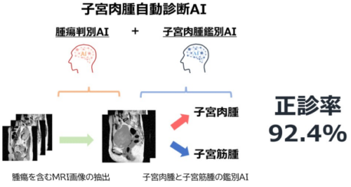 AIで子宮肉腫の術前診断を自動化するシステムを開発