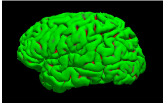 将来の脳画像を予測する生成 AI を開発～生活習慣改善や脳ドックの付加価値向上に貢献～