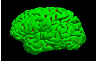 将来の脳画像を予測する生成 AI を開発～生活習慣改善や脳ドックの付加価値向上に貢献～