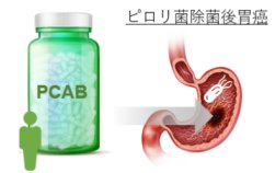 過度の胃酸抑制は胃癌発生を助長する?～胃酸分泌抑制薬の功罪～