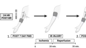 1日1ビートは心臓病を遠ざけるか?(Does a beet a day keep heart disease away?)