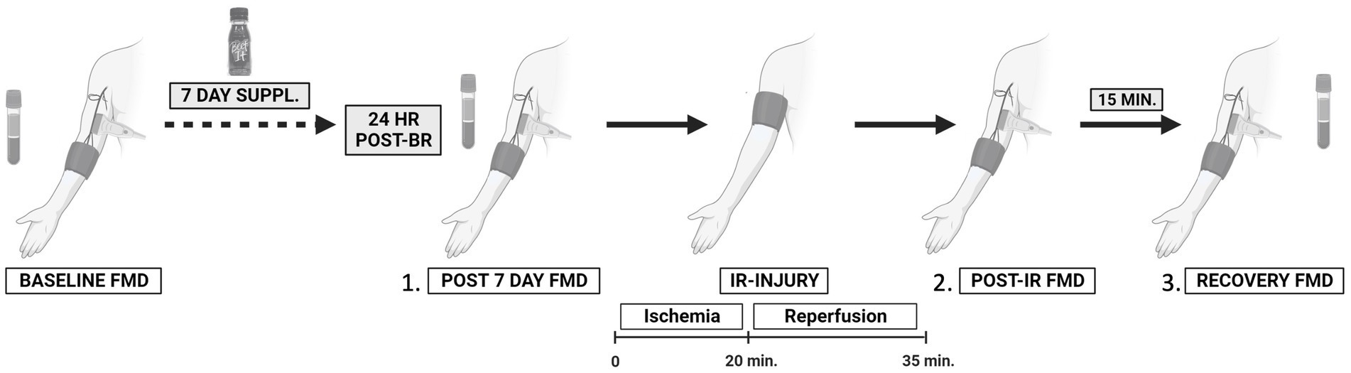 1日1ビートは心臓病を遠ざけるか?(Does a beet a day keep heart disease away?)