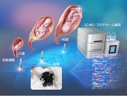 新生児のうんち(初回胎便)のタンパク質組成を解明～性別、在胎週数、疾患の有無で異なる～
