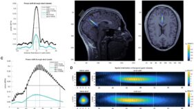 超音波技術でマインドフルネスを高める研究(Ultrasound technology can be used to boost mindfulness, study finds)