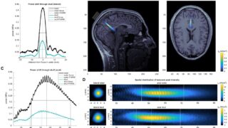 超音波技術でマインドフルネスを高める研究(Ultrasound technology can be used to boost mindfulness, study finds)