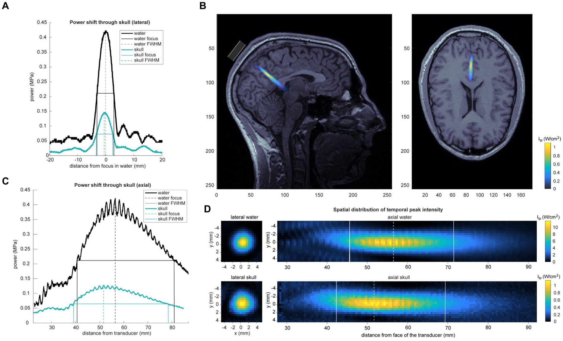 超音波技術でマインドフルネスを高める研究(Ultrasound technology can be used to boost mindfulness, study finds)