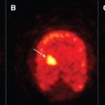 傷害リスクのある馬の特定に有望な運動センサー(Movement sensors show promise in identifying horses at injury risk)