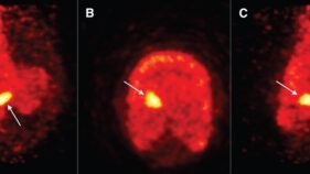 傷害リスクのある馬の特定に有望な運動センサー(Movement sensors show promise in identifying horses at injury risk)