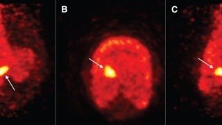 傷害リスクのある馬の特定に有望な運動センサー(Movement sensors show promise in identifying horses at injury risk)