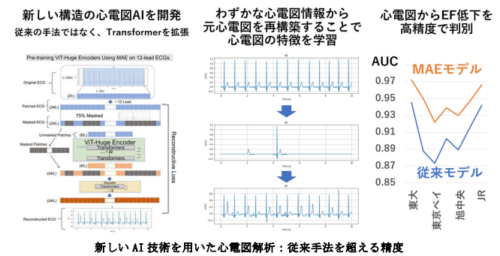 心電図解析に画期的なAI技術を導入、多施設データで高精度を実現～多施設データを用いたMAE手法でECG解析の精度を大幅向上～