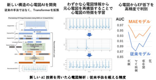 心電図解析に画期的なAI技術を導入、多施設データで高精度を実現~多施設データを用いたMAE手法でECG解析の精度を大幅向上~ 心電図解析に画期的なAI技術を導入、多施設データで高精度を実現~多施設データを用いたMAE手法でECG解析の精度を大幅向上~