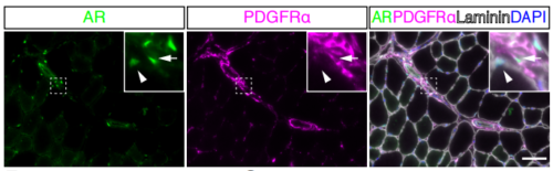 男性ホルモンが骨格筋を制御する新たなメカニズムを解明〜筋萎縮に対する新規療法に期待〜