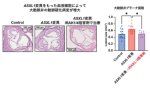 白血病関連遺伝子変異を有する血液が心筋梗塞や脳梗塞を誘導するメカニズムの解明～ASXL1変異は炎症の増悪と遷延化を介して動脈硬化を誘導する～
