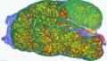 ショーグレン症候群のメカニズムの解明 (Researchers Reveal Mechanisms Underlying Sjogren’s Disease)