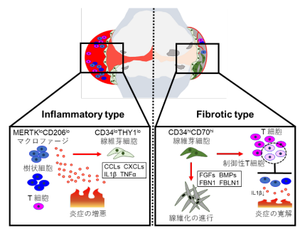 変形性膝関節症の病型を規定する滑膜線維芽細胞集団を同定