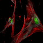 ゾンビ細胞の形状とサブタイプ特定(Are ‘Zombie’ Skin Cells Harmful or Helpful?)