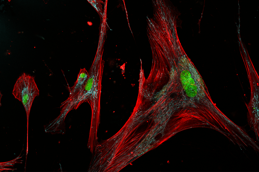 ゾンビ細胞の形状とサブタイプ特定(Are ‘Zombie’ Skin Cells Harmful or Helpful?)