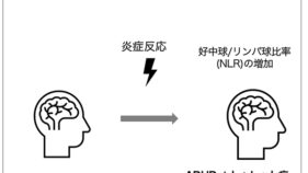 ADHDの子どもにおけるトゥレット症の発症に炎症が関与する可能性～トゥレット症のリスクを予測する新たな生体指標の手がかり～