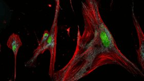 ゾンビ細胞の形状とサブタイプ特定(Are ‘Zombie’ Skin Cells Harmful or Helpful?)