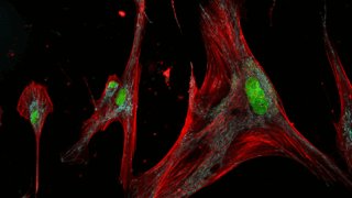 ゾンビ細胞の形状とサブタイプ特定(Are ‘Zombie’ Skin Cells Harmful or Helpful?)