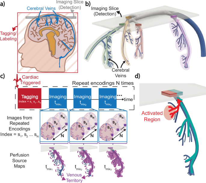 新しいMRI手法が脳生理学への理解を深める(New MRI Method Offers Deeper Insight into Brain Physiology)