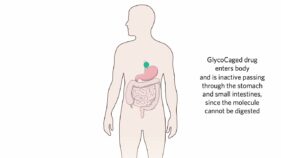 腸内での標的薬物治療に有望な「消化の宝箱」(A digestive ‘treasure chest’ shows promise for targeted drug treatment in the gut)