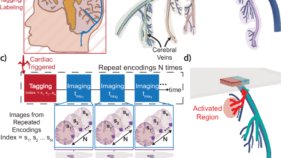 新しいMRI手法が脳生理学への理解を深める(New MRI Method Offers Deeper Insight into Brain Physiology)