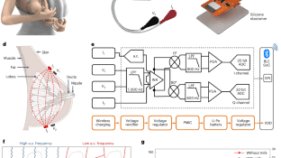データはありますか?母乳育児デバイスが赤ちゃんのミルク摂取量をリアルタイムで測定(Got data? Breastfeeding device measures babies&rsquo; milk intake in real time)