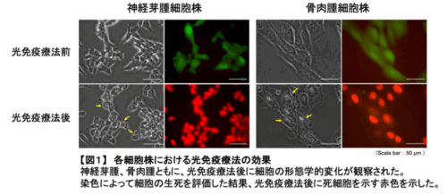 ⼩児がん(神経芽腫および⾻⾁腫)に対して光免疫療法が有⽤な可能性があります!