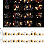 嗅覚から食欲への神経回路を解明(Sniffing out hunger: a nose-to-brain connection linked to appetite)
