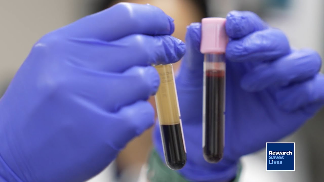 アルツハイマー病の診断を変える可能性のある血液検査(Alzheimer’s blood test could be a ‘game-changer’)