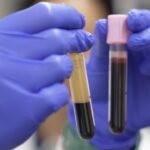 アルツハイマー病の診断を変える可能性のある血液検査(Alzheimer’s blood test could be a ‘game-changer’)