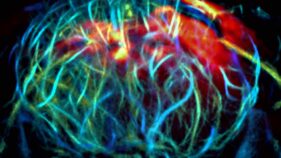 深部組織イメージング用の光感受性分子を開発(Light-Sensitive Molecule Allows Researchers to Visualize and Manipulate Cells in Deep Tissues)